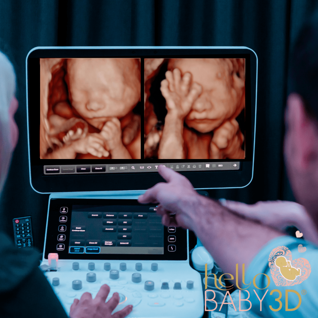 20 Weeks 3d Ultrasound Pictures 20 Week 3d Ultrasound