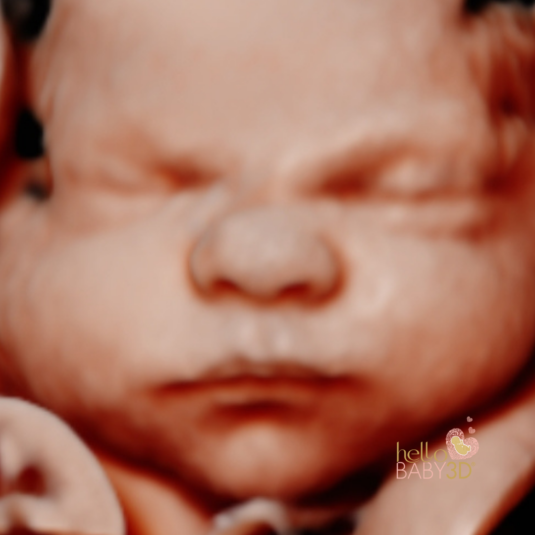 59.png