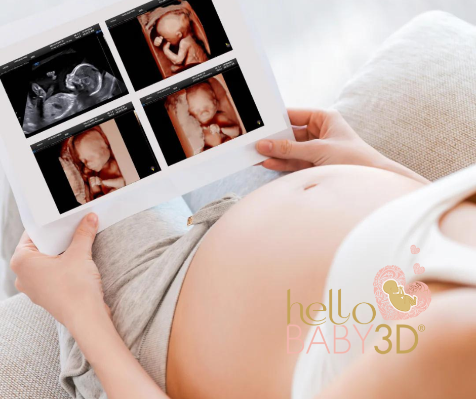 Ultrasound Carasol Advert - 1.PNG