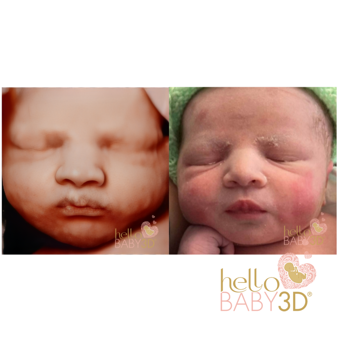 Hello Baby Deluxe 3D Pregnancy Ultrasound (20-40 weeks) (10).png