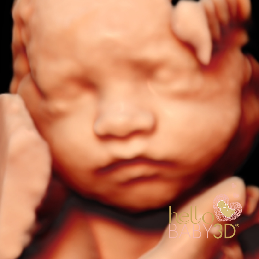 Reassurance 3D Pregnancy Ultrasound (20-40 weeks) (3).png