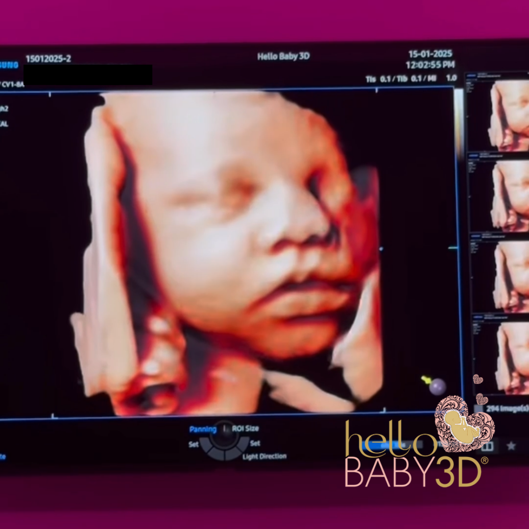 Hello Baby Premium 3D Pregnancy Ultrasound (28-40 weeks) (10).png