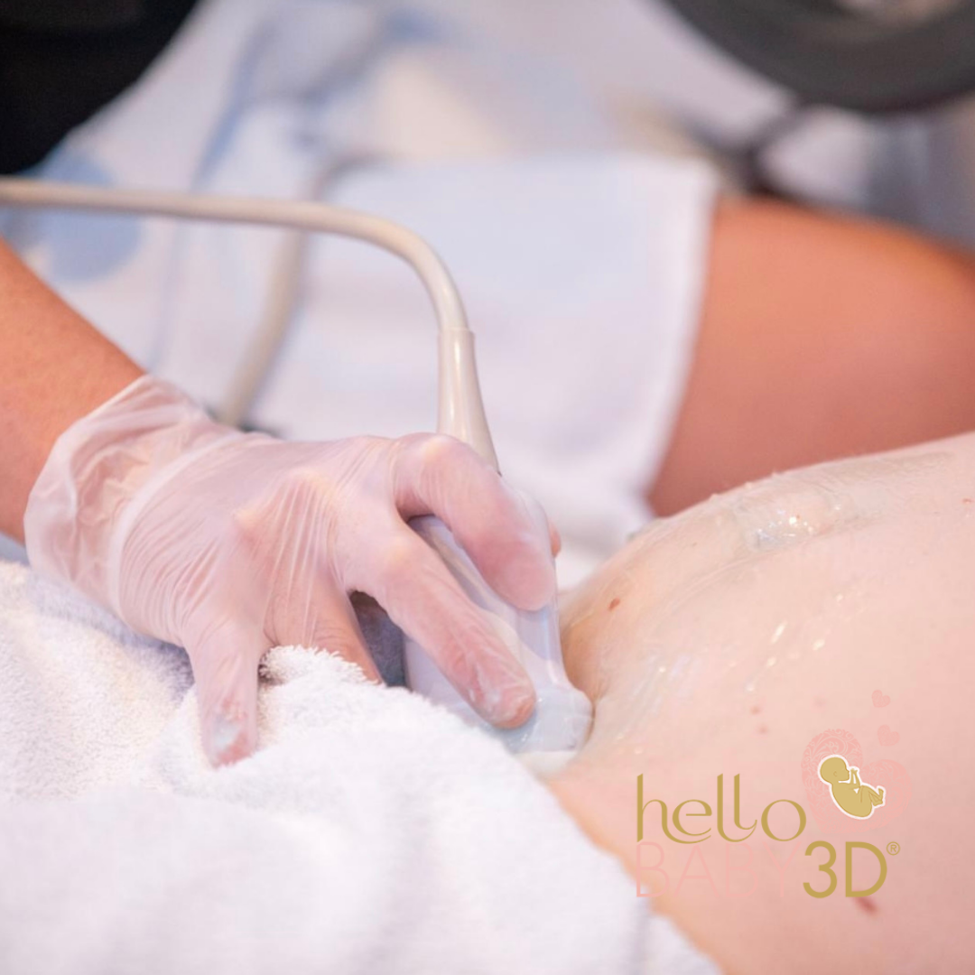 Reassurance 3D Pregnancy Ultrasound (14-19 weeks) (4).png