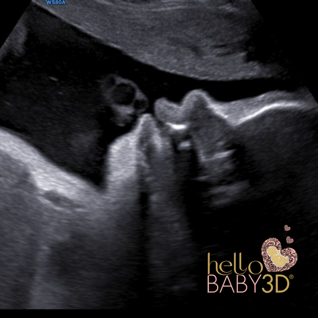 Reassurance 3D Pregnancy Ultrasound (20-40 weeks) (4).png