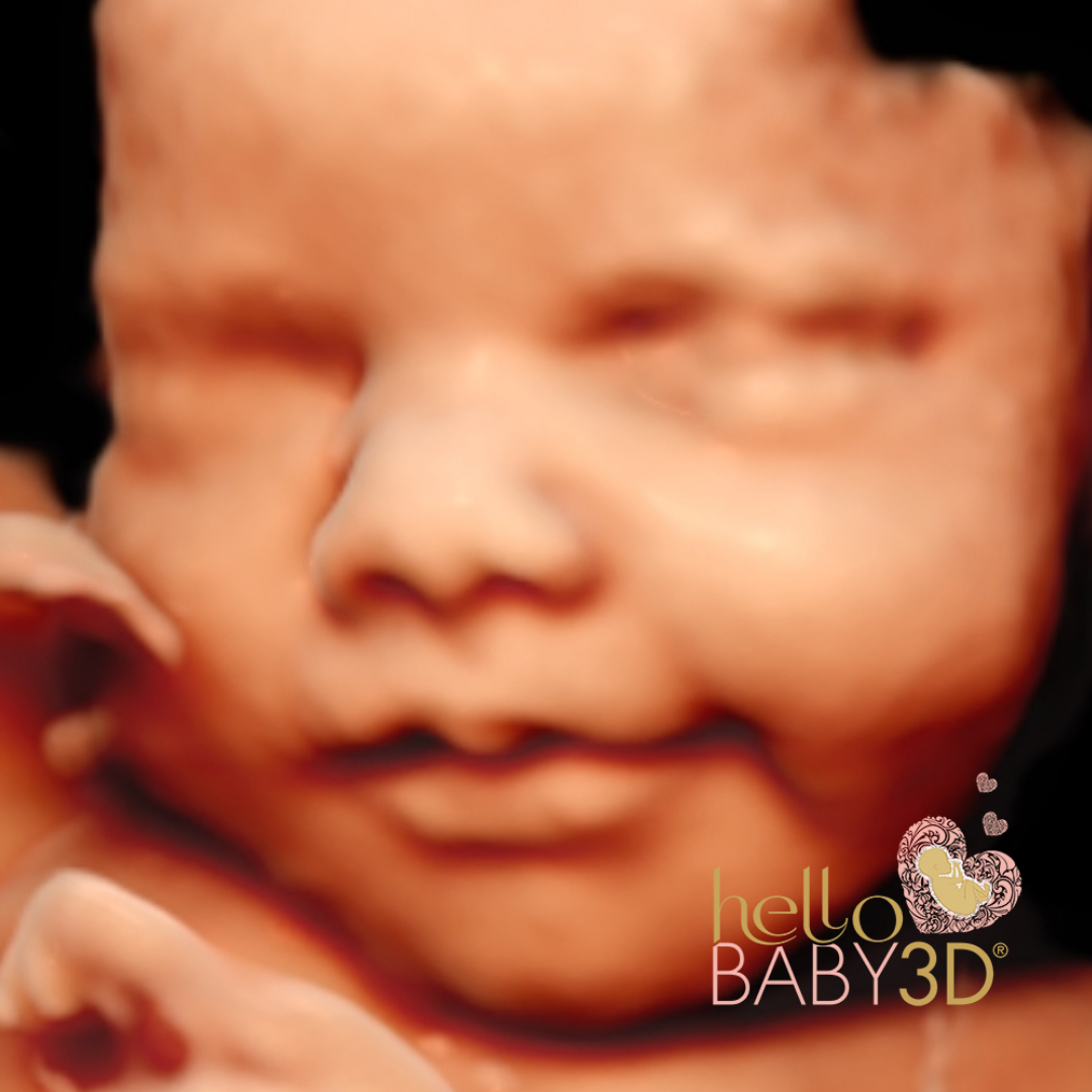 Hello Baby Premium 3D Pregnancy Ultrasound (28-40 weeks) (7).png