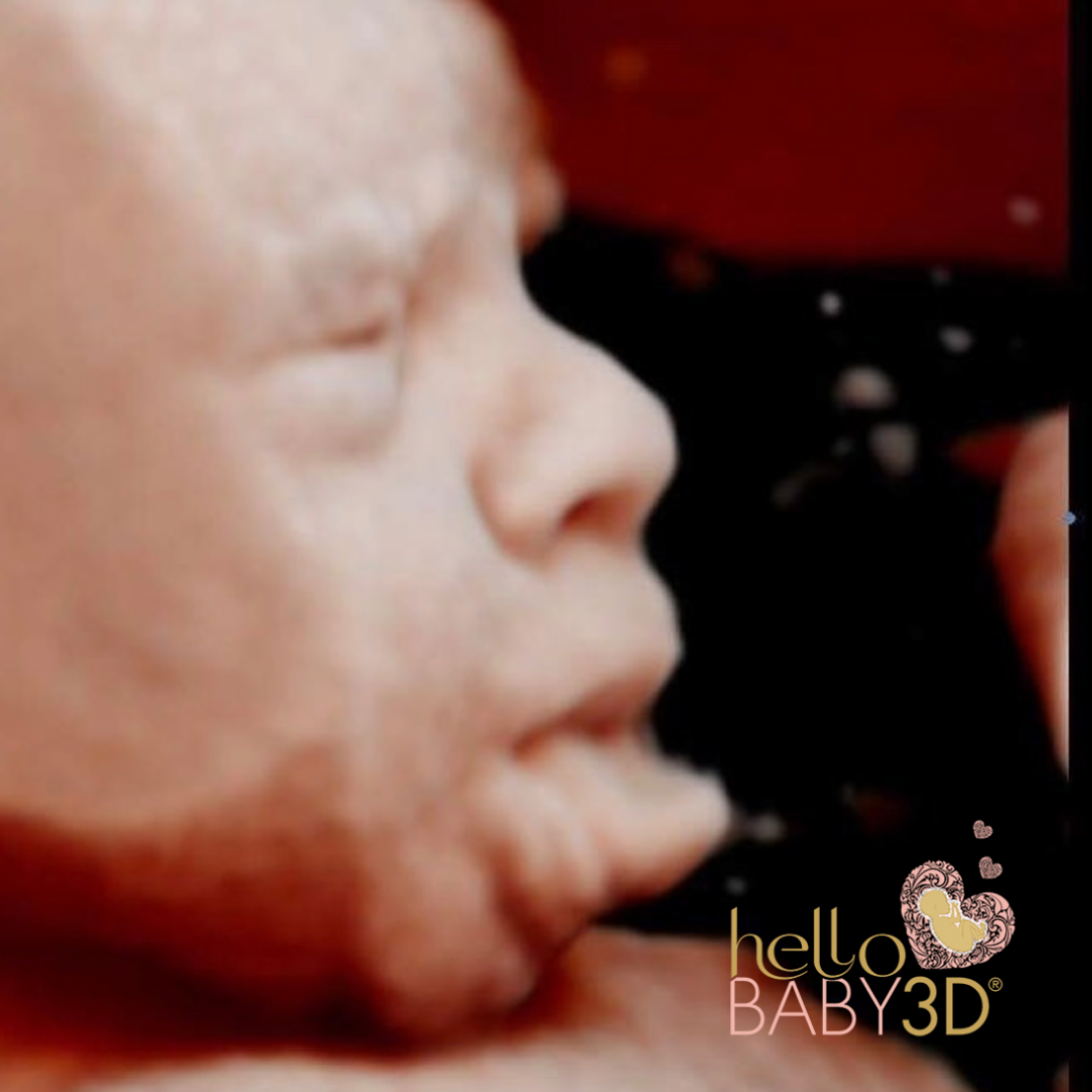 Hello Baby Deluxe 3D Pregnancy Ultrasound (20-40 weeks) (9).png