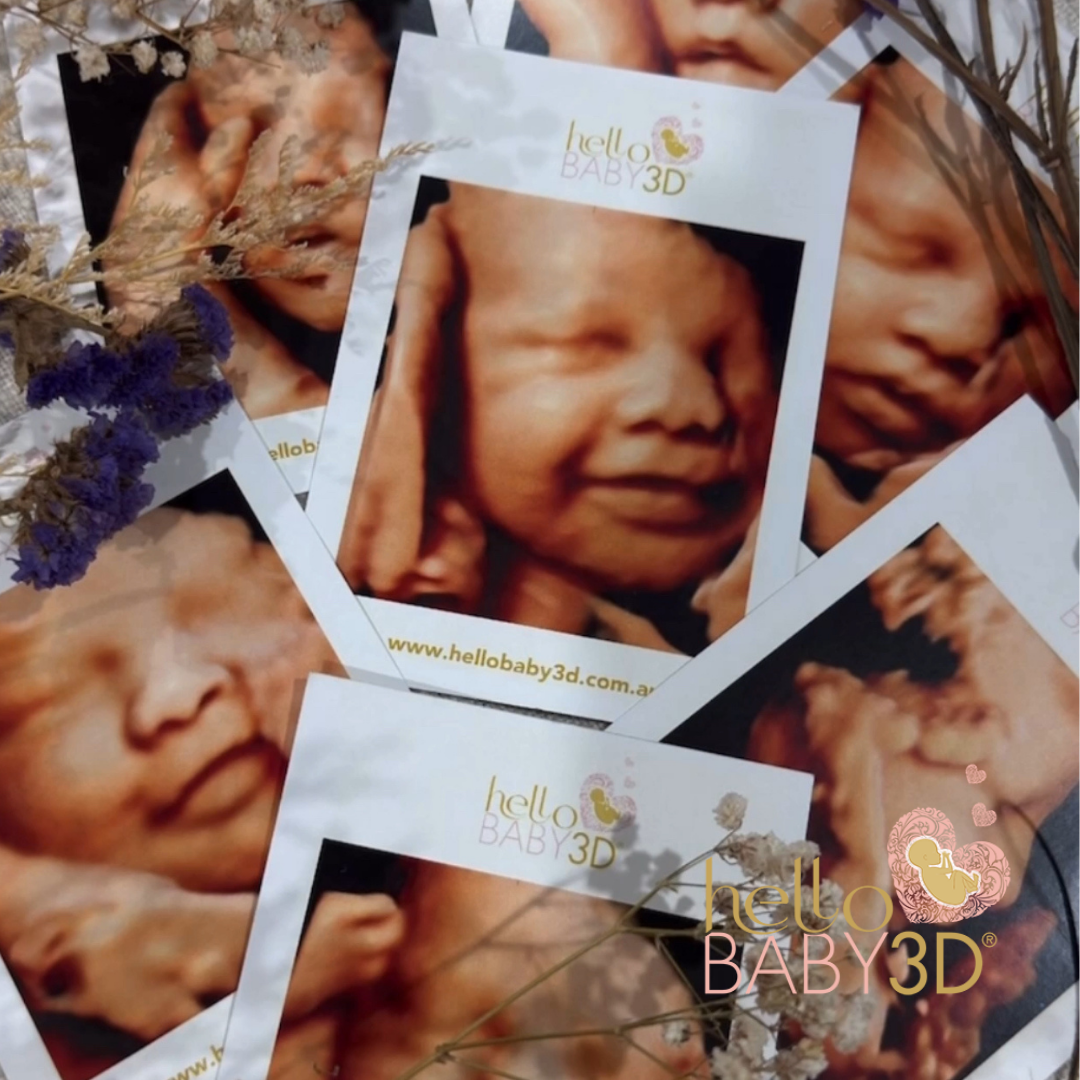 Hello Baby Premium 3D Pregnancy Ultrasound (28-40 weeks) (4).png