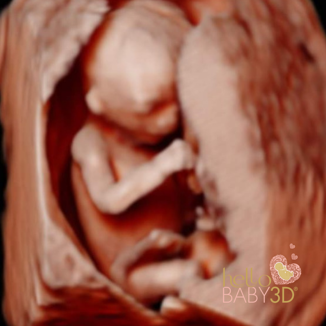 3D Gender Pregnancy Ultrasound (14 to 40 weeks) (3).png