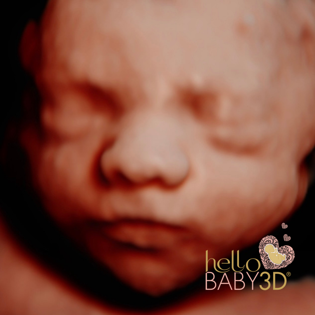 Hello Baby Premium 3D Pregnancy Ultrasound (28-40 weeks) (9).png