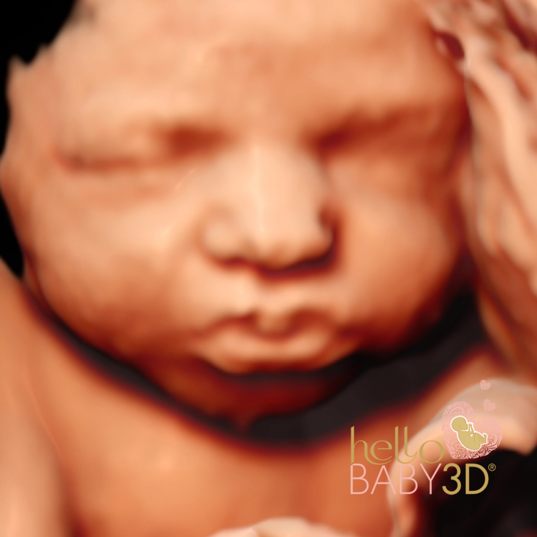Hello Baby Deluxe 3D Pregnancy Ultrasound (20-40 weeks) (5).png