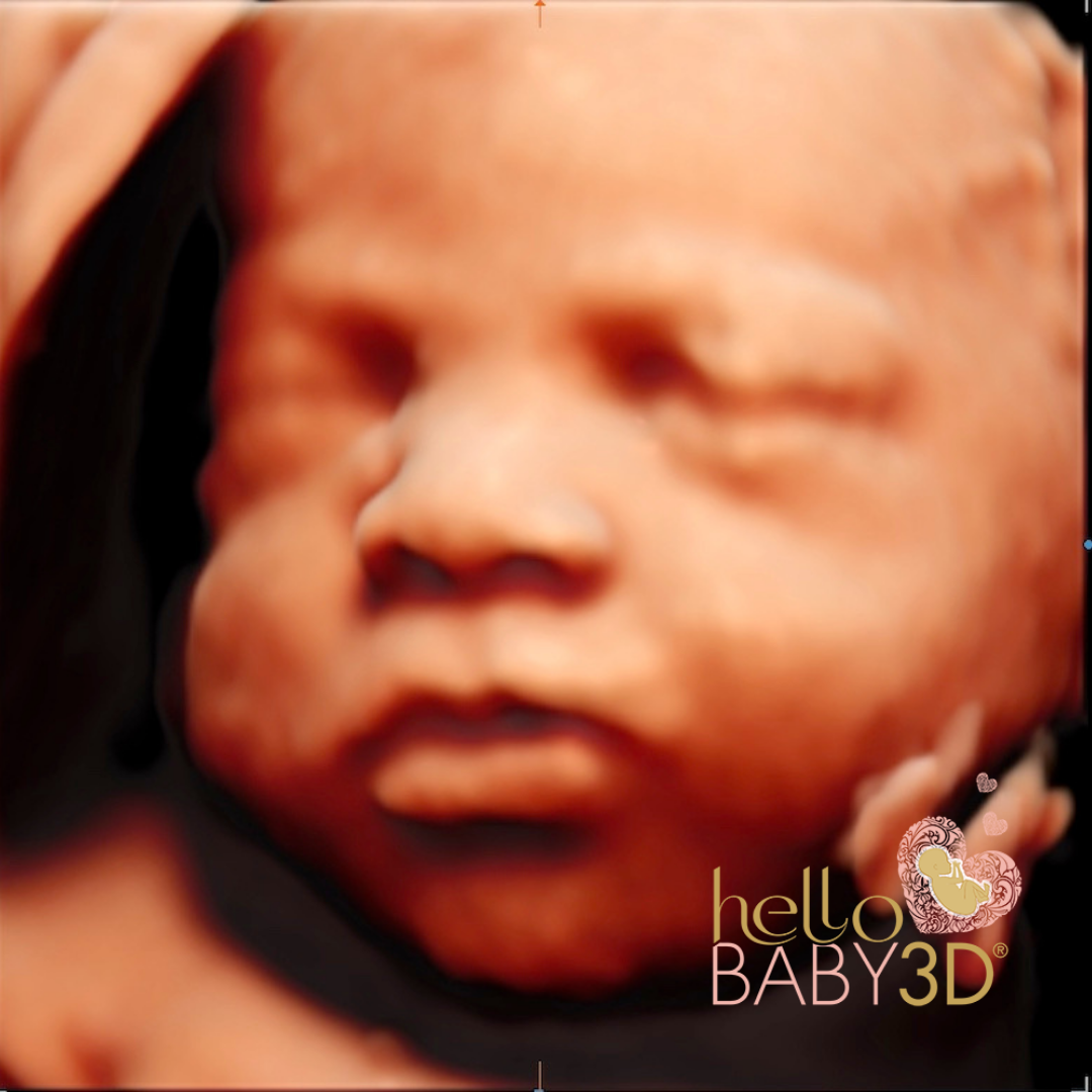 Hello Baby Deluxe 3D Pregnancy Ultrasound (20-40 weeks) (12).png