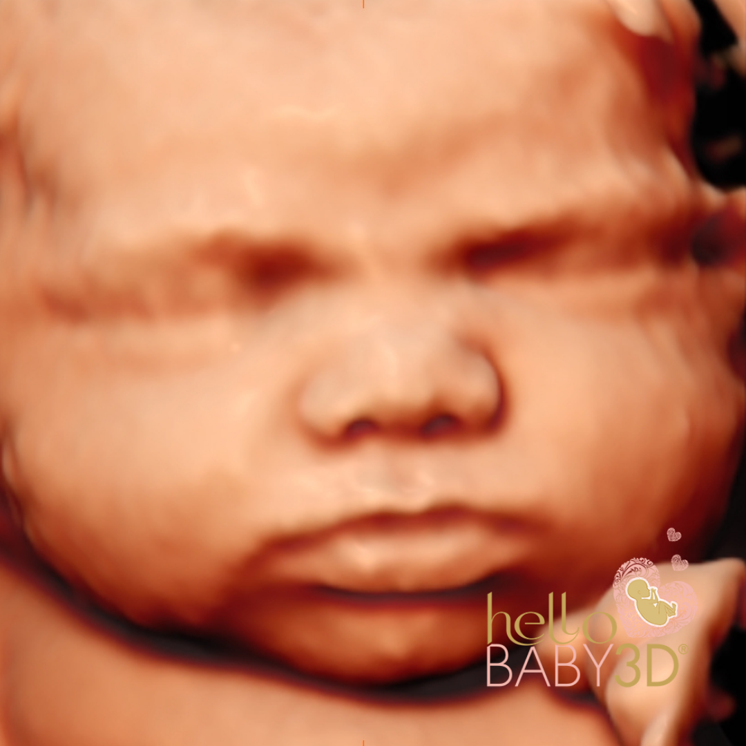 Hello Baby Deluxe 3D Pregnancy Ultrasound (20-40 weeks) (11).png