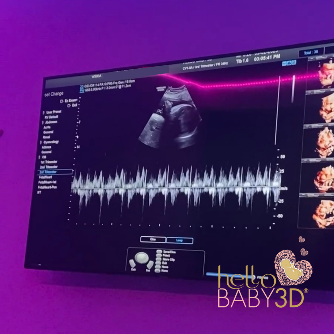 2D Gender Pregnancy Ultrasound (14 to 40 weeks) (5).png
