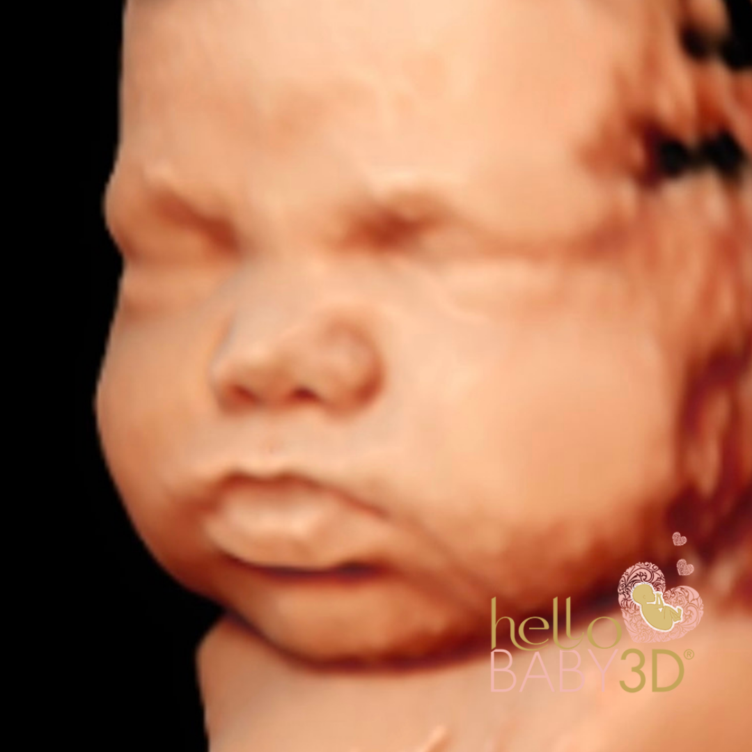 Hello Baby Premium 3D Pregnancy Ultrasound (28-40 weeks) (3).png