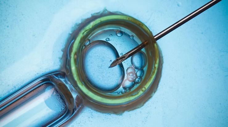 30年保存された胚で行われた治療と同様の体外受精のイメージ