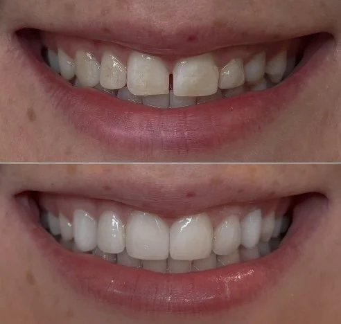 Smile Society Dentistry - Ottawa Dentist