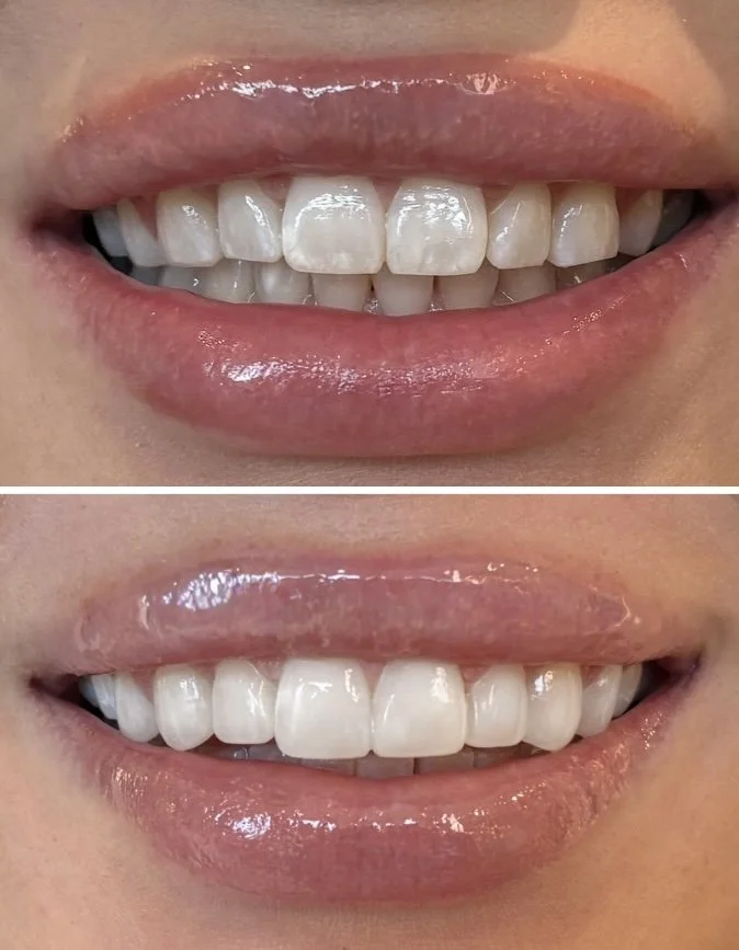 Smile Society Dentistry - Ottawa Dentist