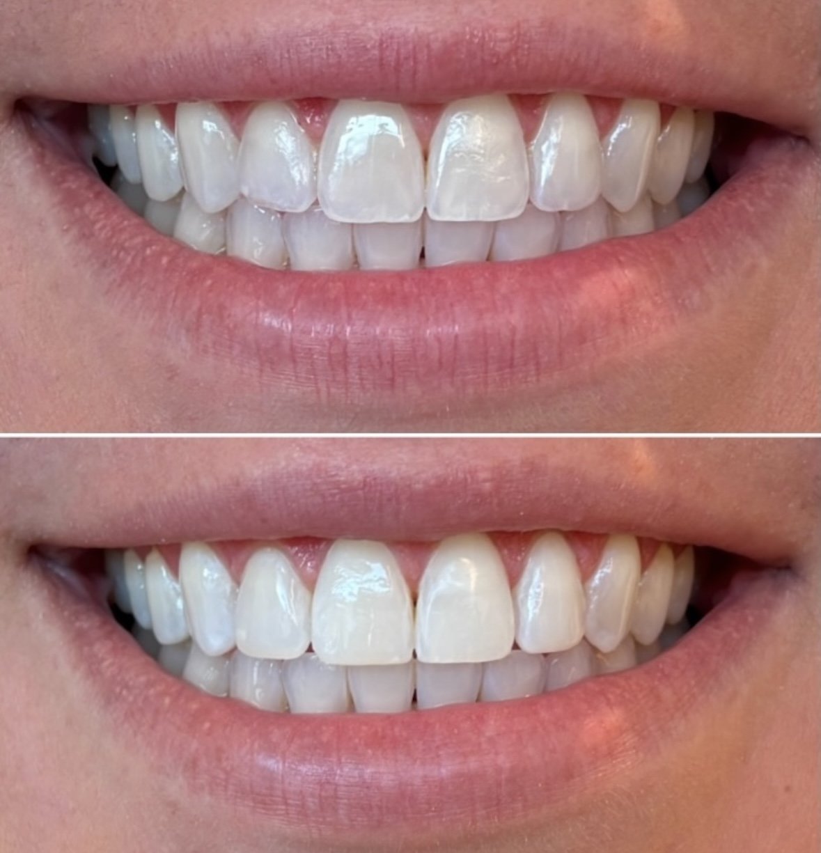 Smile Society Dentistry - Ottawa Dentist