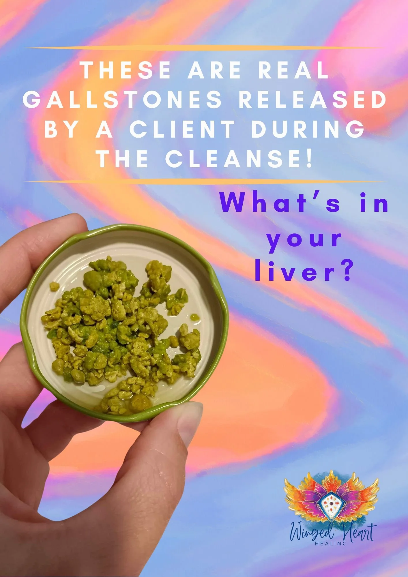 Real Gallstones from a LIver Flush with Nik Heartsong Winged Heart Healing
