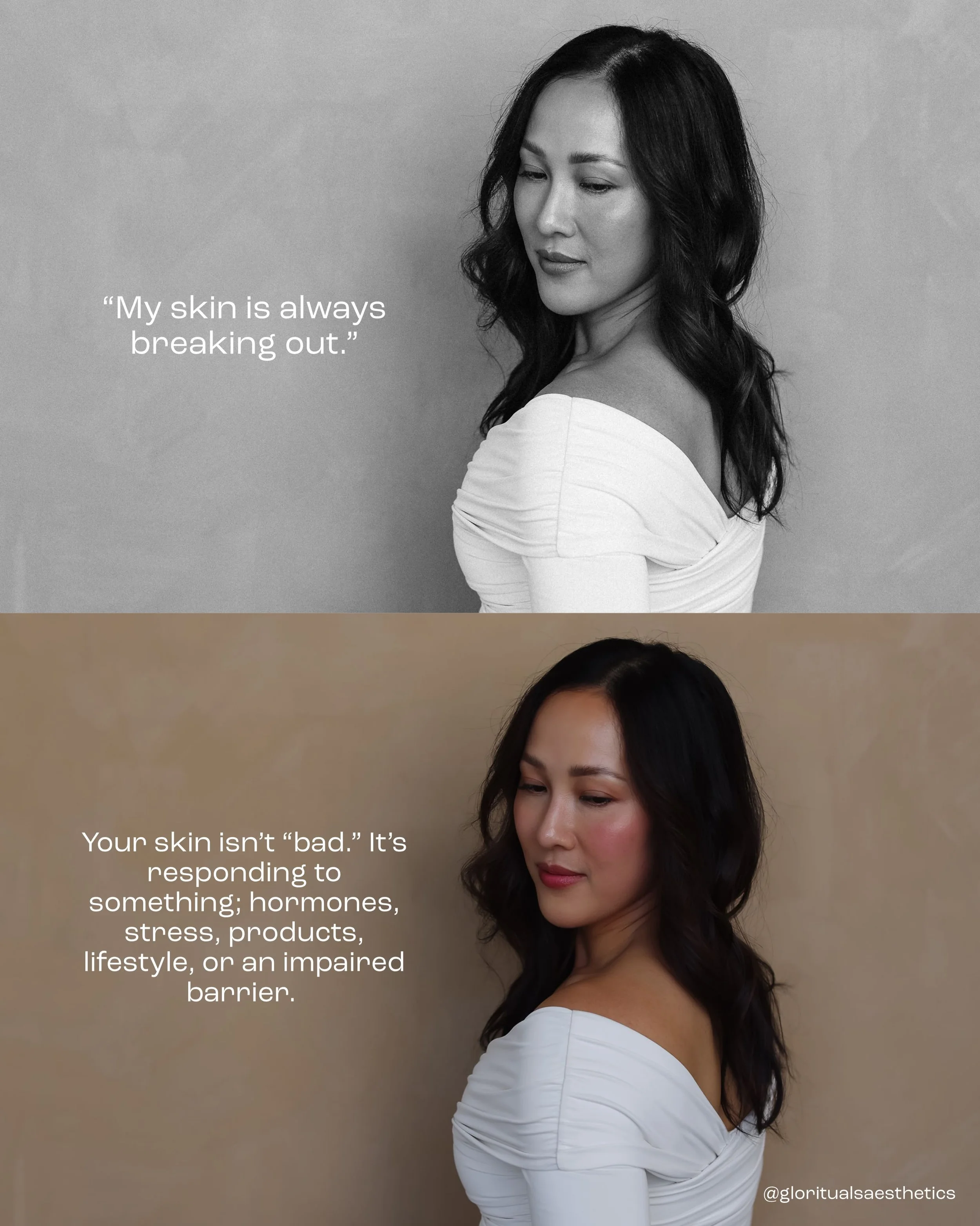 Your mindset is just as important as your treatment plan. 

A skin journey isn&rsquo;t about overnight perfection, it&rsquo;s about consistency, patience, and trusting the process.

When you become a patient at Glo Rituals, we&rsquo;re not just treat