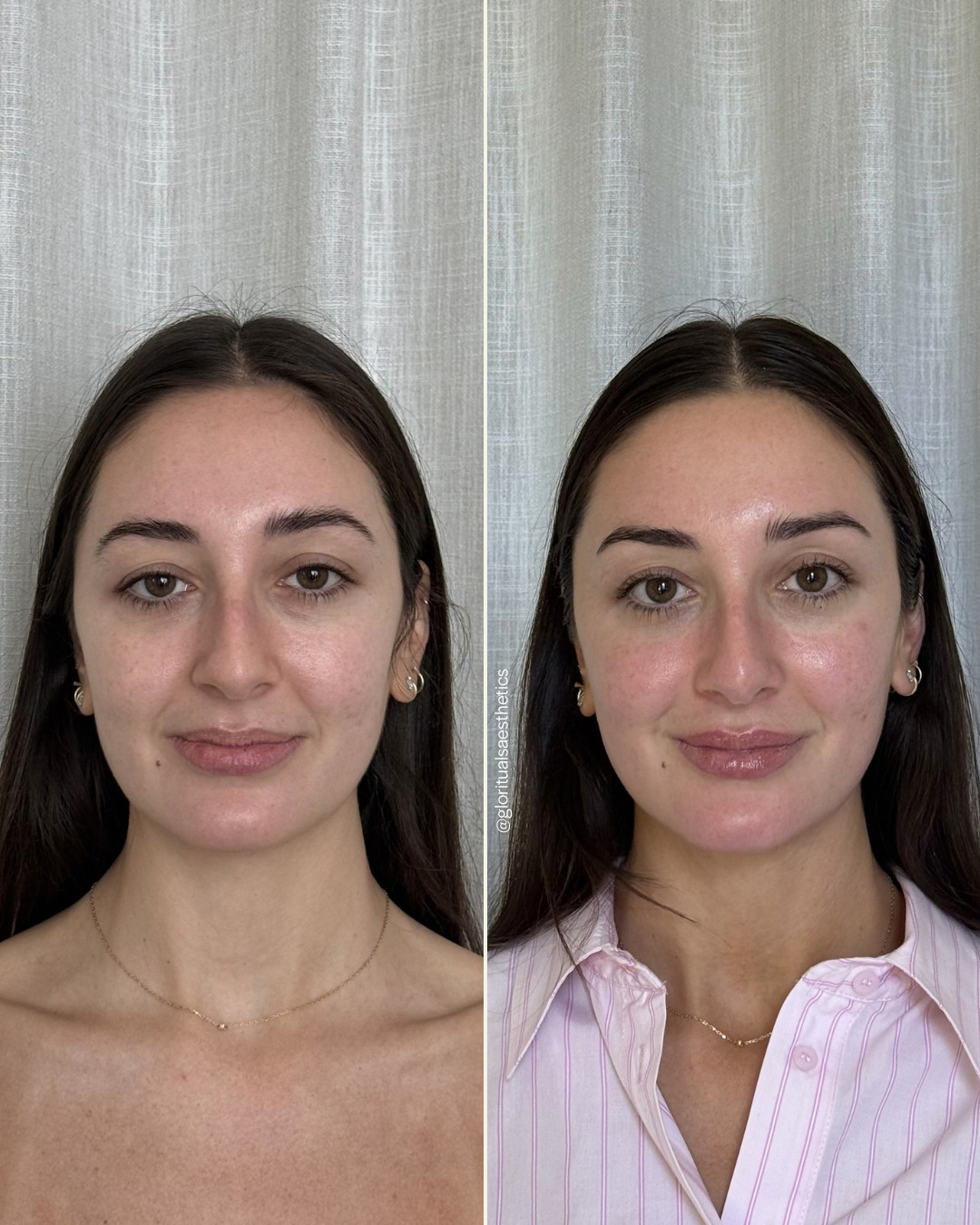 Side-by-side comparison of a woman showing a before and after look, with improved skin appearance and makeup application in the after photo, against a light-colored textured background.