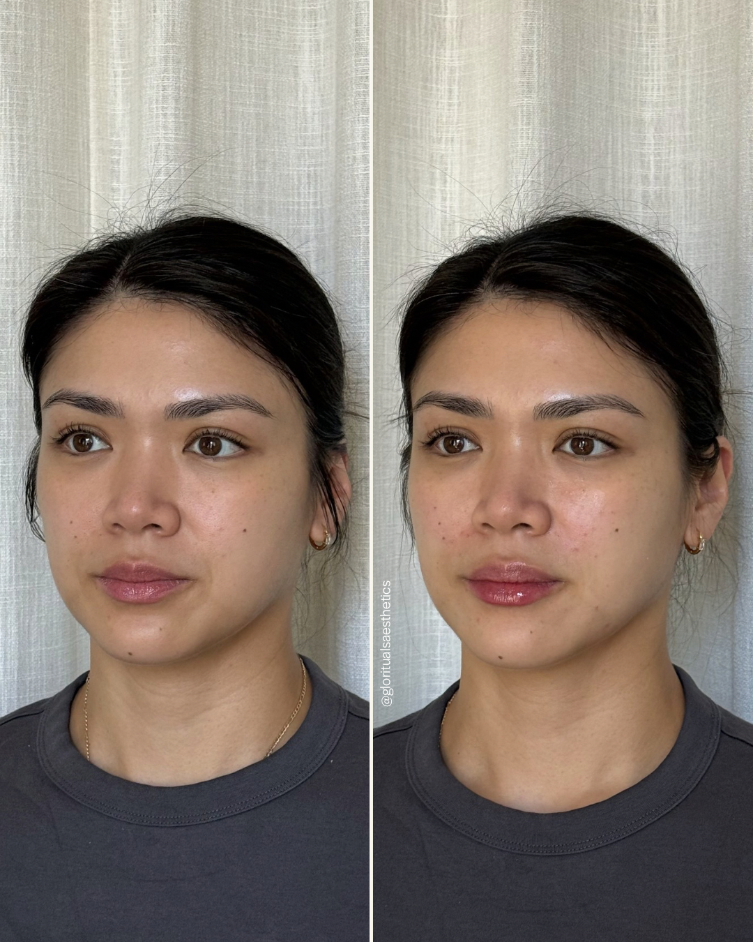 Side-by-side comparison of a woman before and after applying a skincare or makeup product, showing a subtle change in facial appearance.