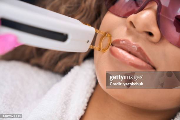 Laser hair removal for face in Spring, Tx