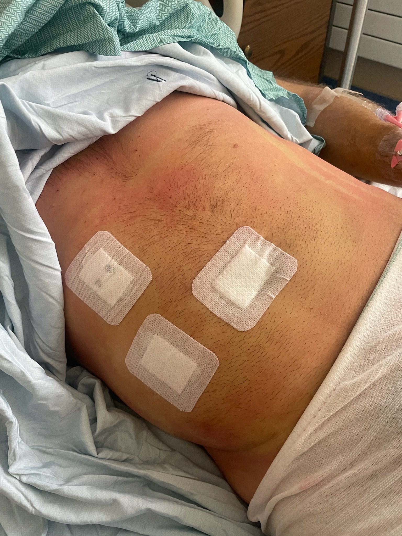 Mystery disease…