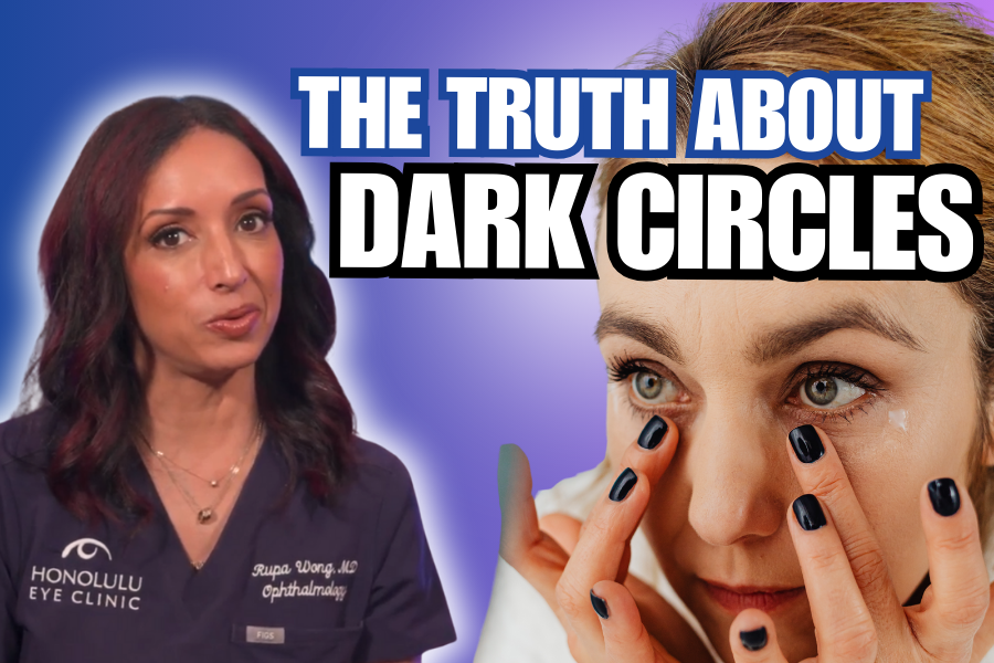 Why Won’t My Dark Circles Go Away? (What Type You Have &amp; What Works)