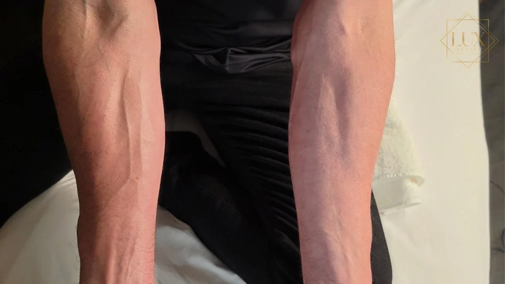 Lymphatic drainage massage treatment at LUX MedSpa Brickell in Miami