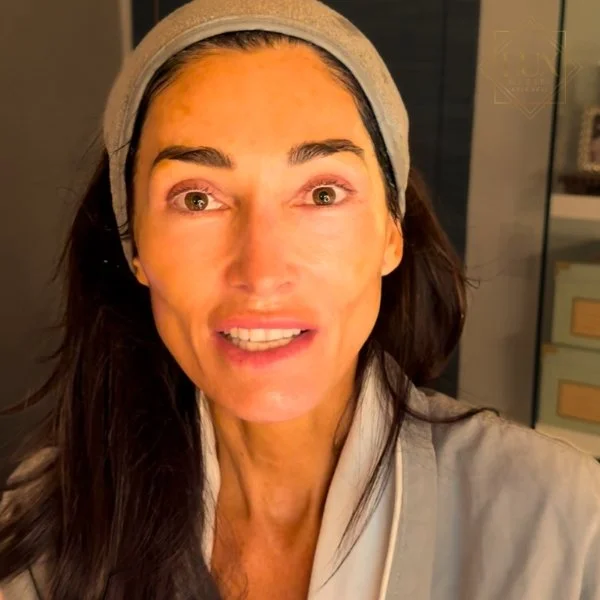 Dara Tomanovich sharing her experience with Alan Araujo at LUX MedSpa Brickell.
