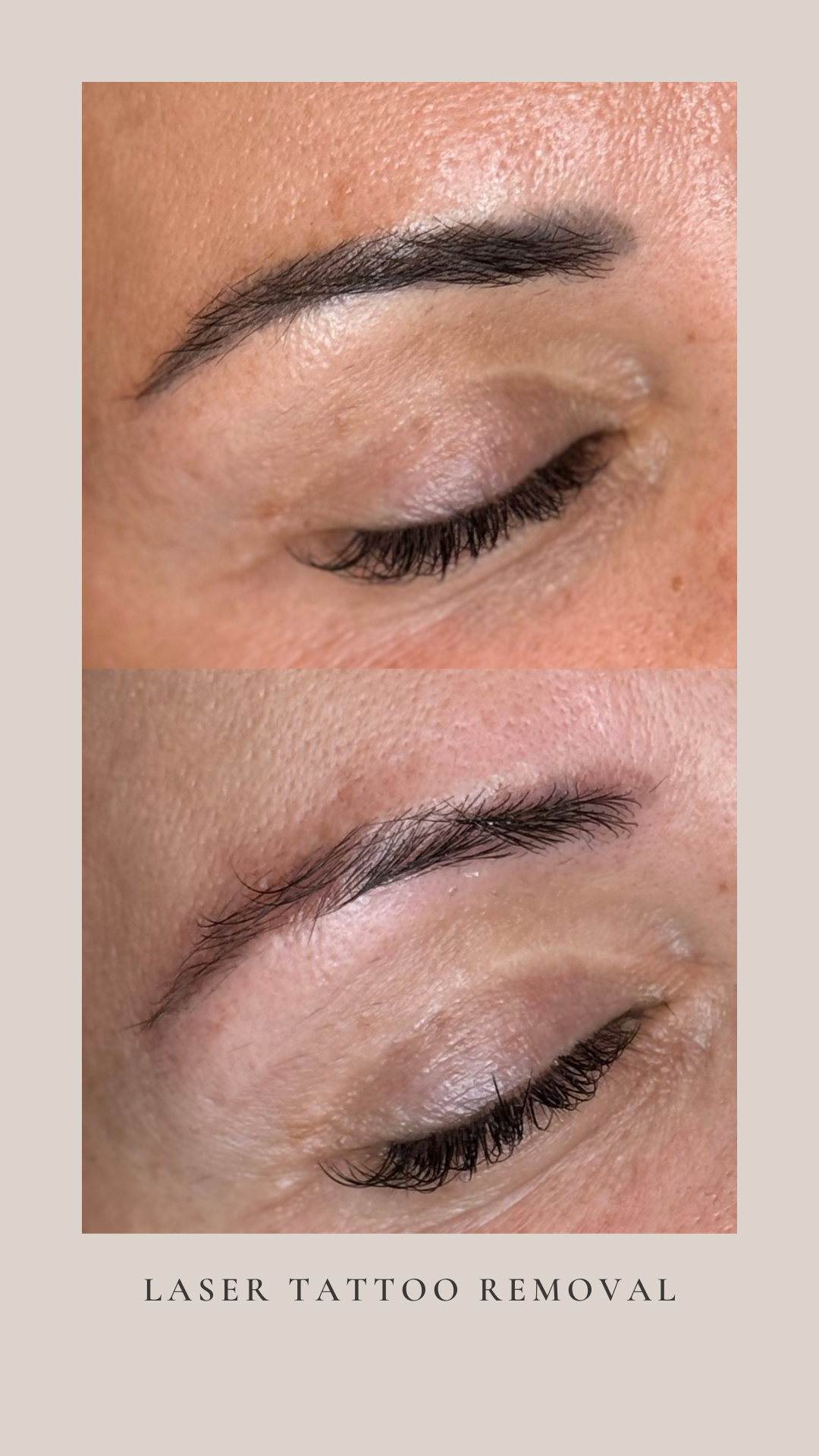 Why Your Old Microblading Turned Grey (And What to Do About It)