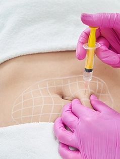 Platelet-rich Plasma (PRP)