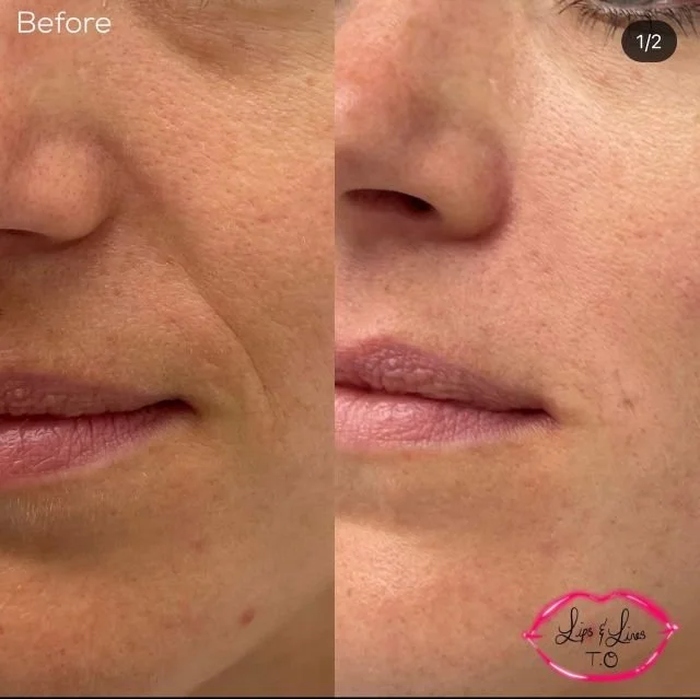 Skin before and after treatment
