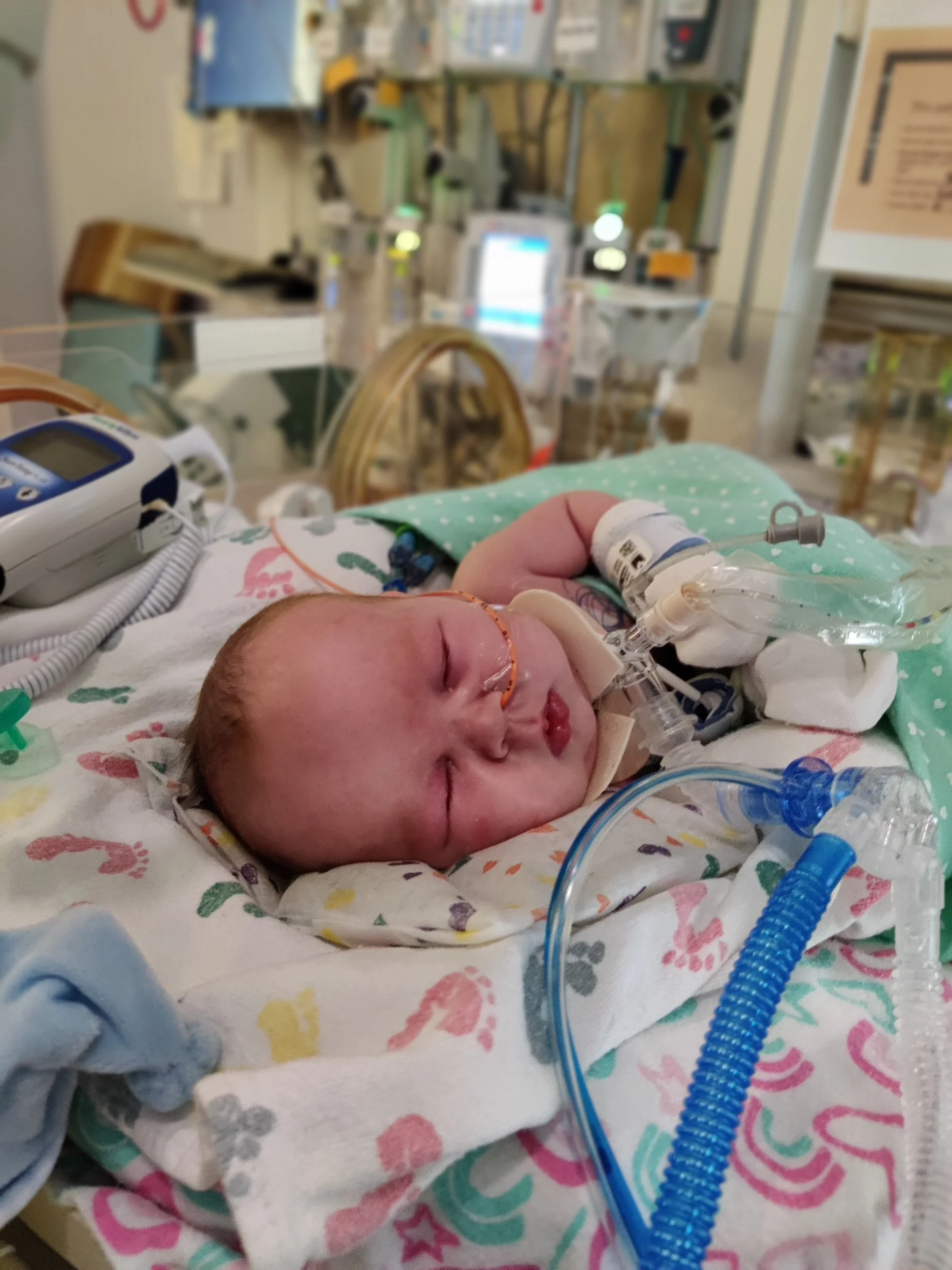 It’s Time To Get A Trach