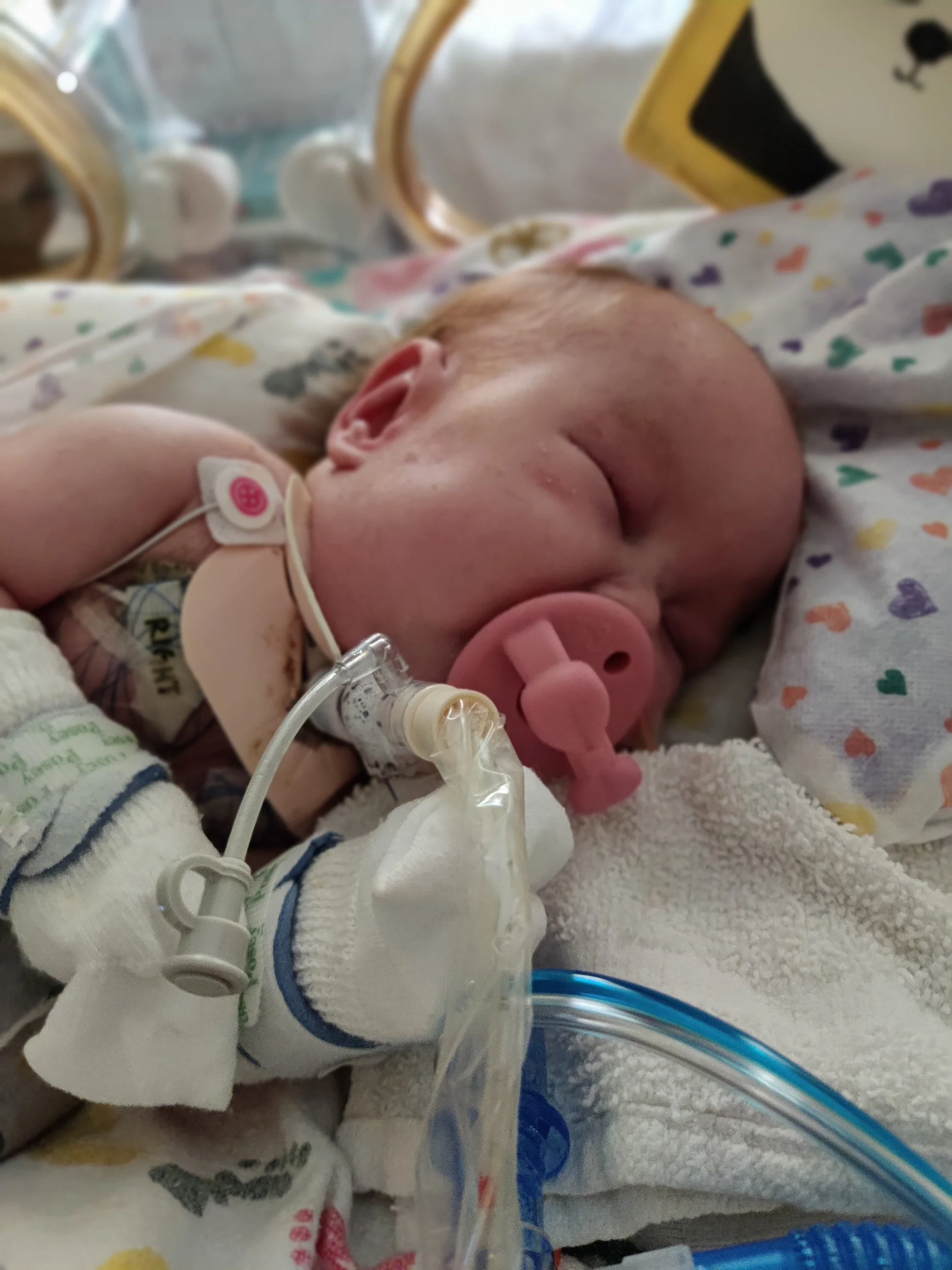 Trach Recovery Time