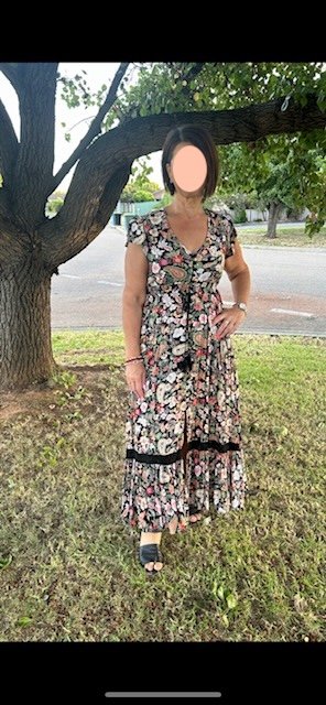 Body weight 65 kg after gastric bypass surgery