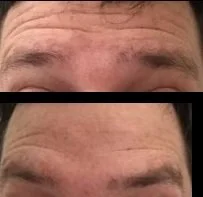 B4AFTER-1.jpg