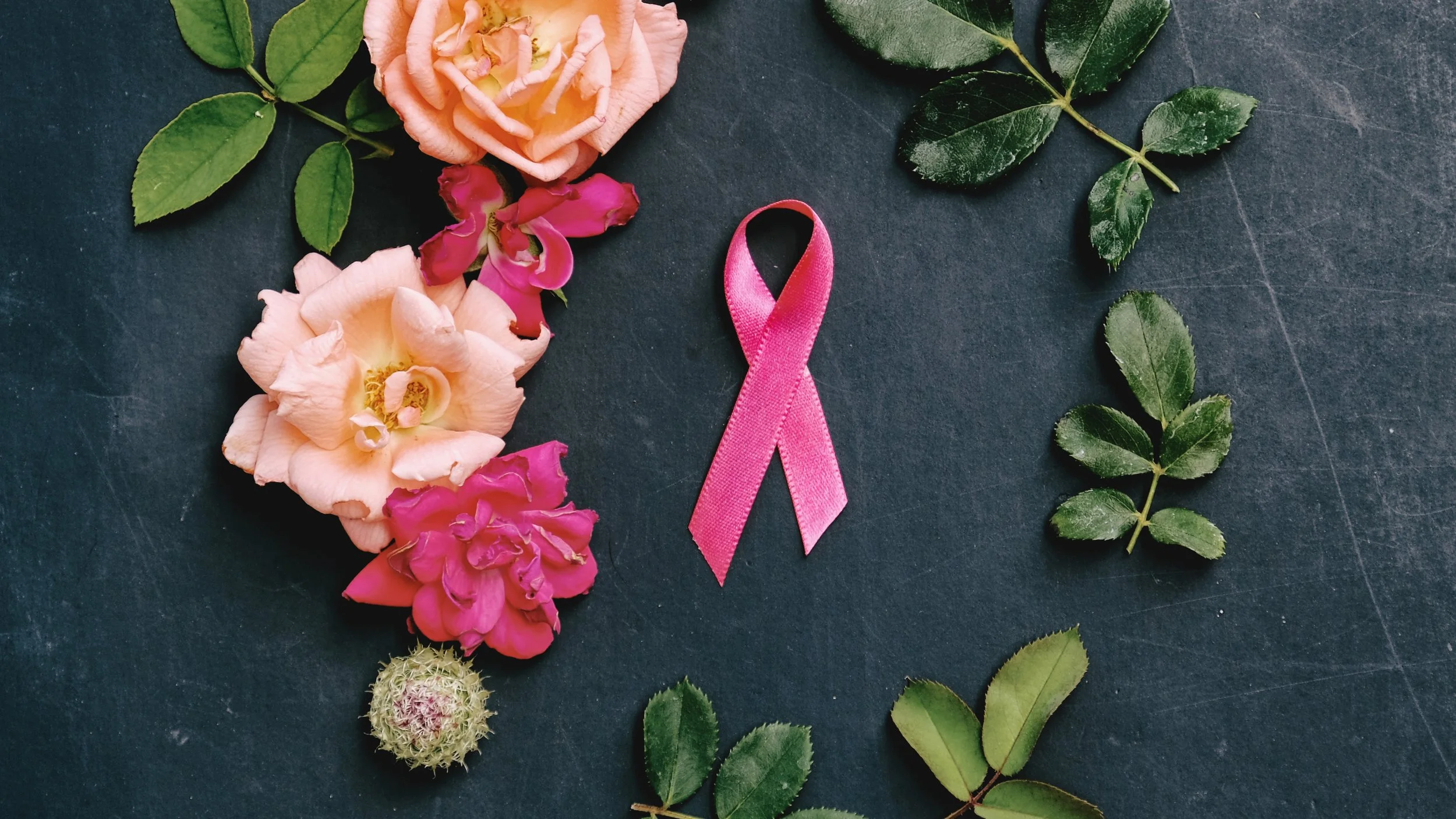 Mammography image 3