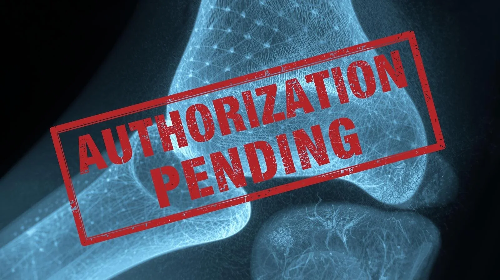 Prior Authorization Challenges for Orthopedic Surgeons