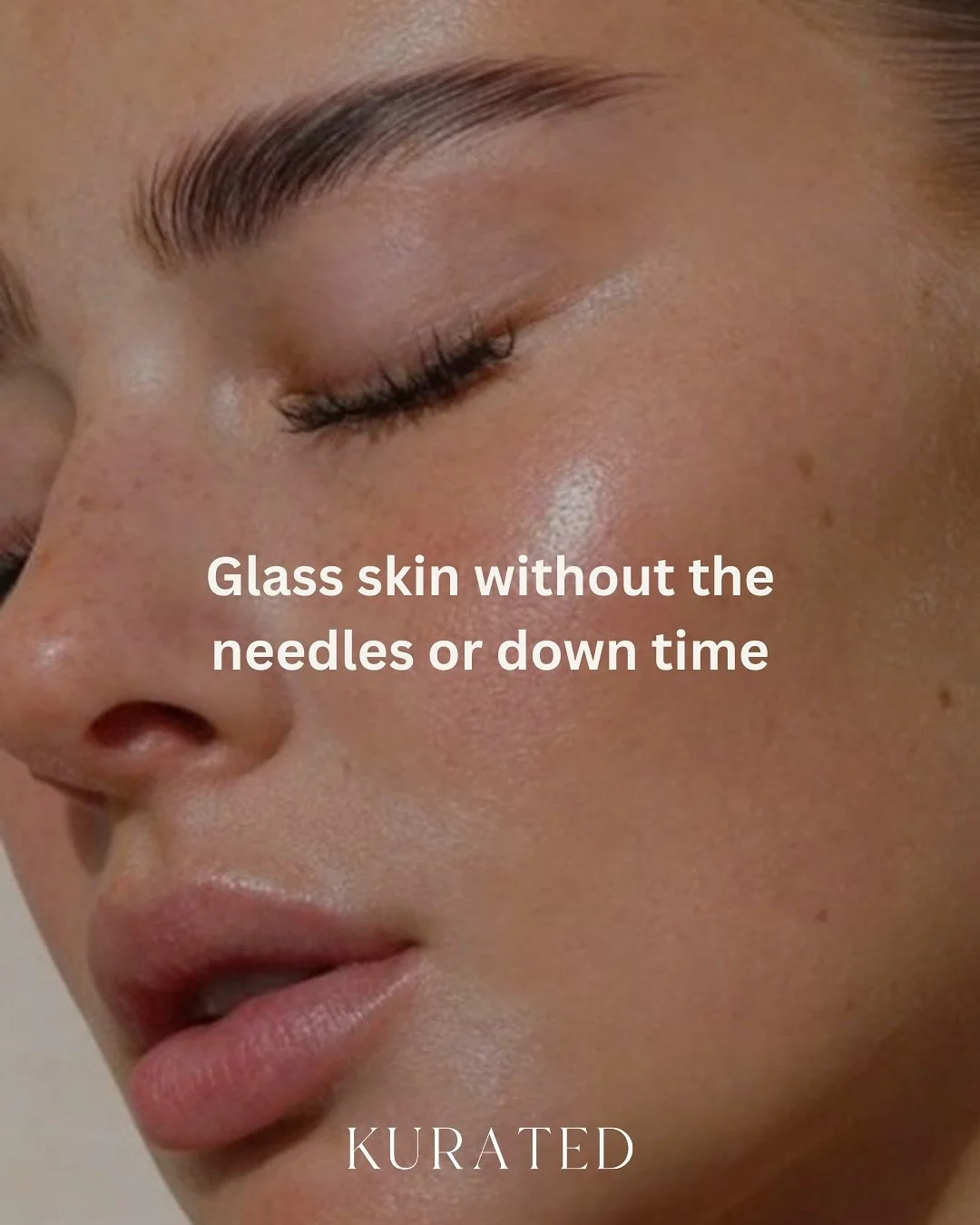 A popular treatment in the clinic this month! 
PRX PLUS - a topical bio stimulator that improves pigmentation, dullness, skin laxity and hydration - WITHOUT the needles or downtime!
- breastfeeding safe
- safe for most skins (not suitable for sensi