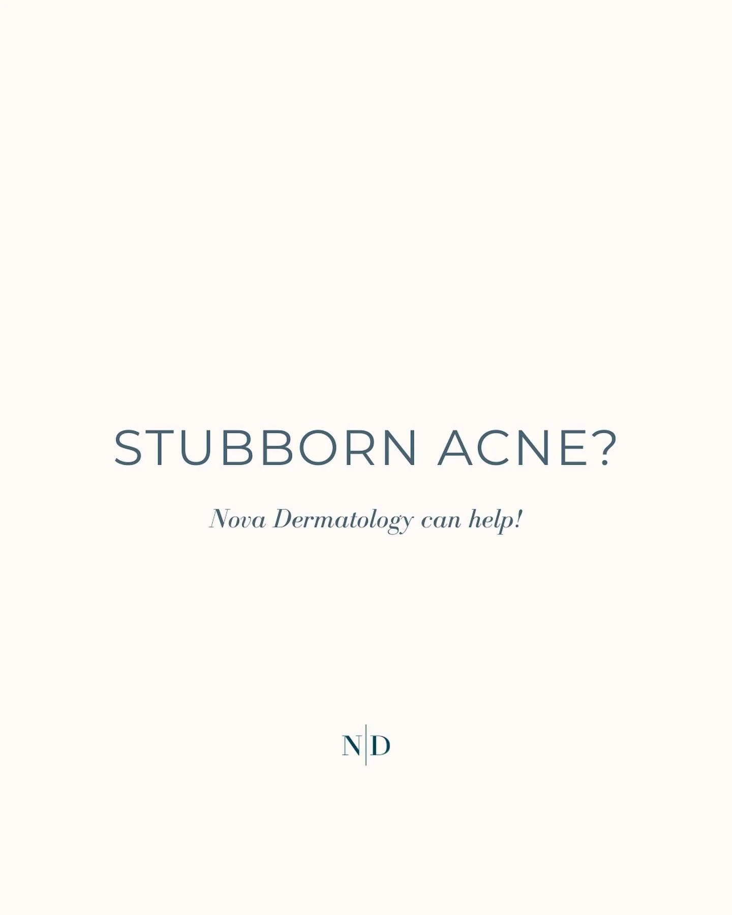 Tired of battling stubborn acne? At Nova Dermatology, we offer a range of tailored solutions, from advanced laser treatments like AviClear to prescription therapies and expert skincare plans. 
Our treatments are designed to help you achieve your best