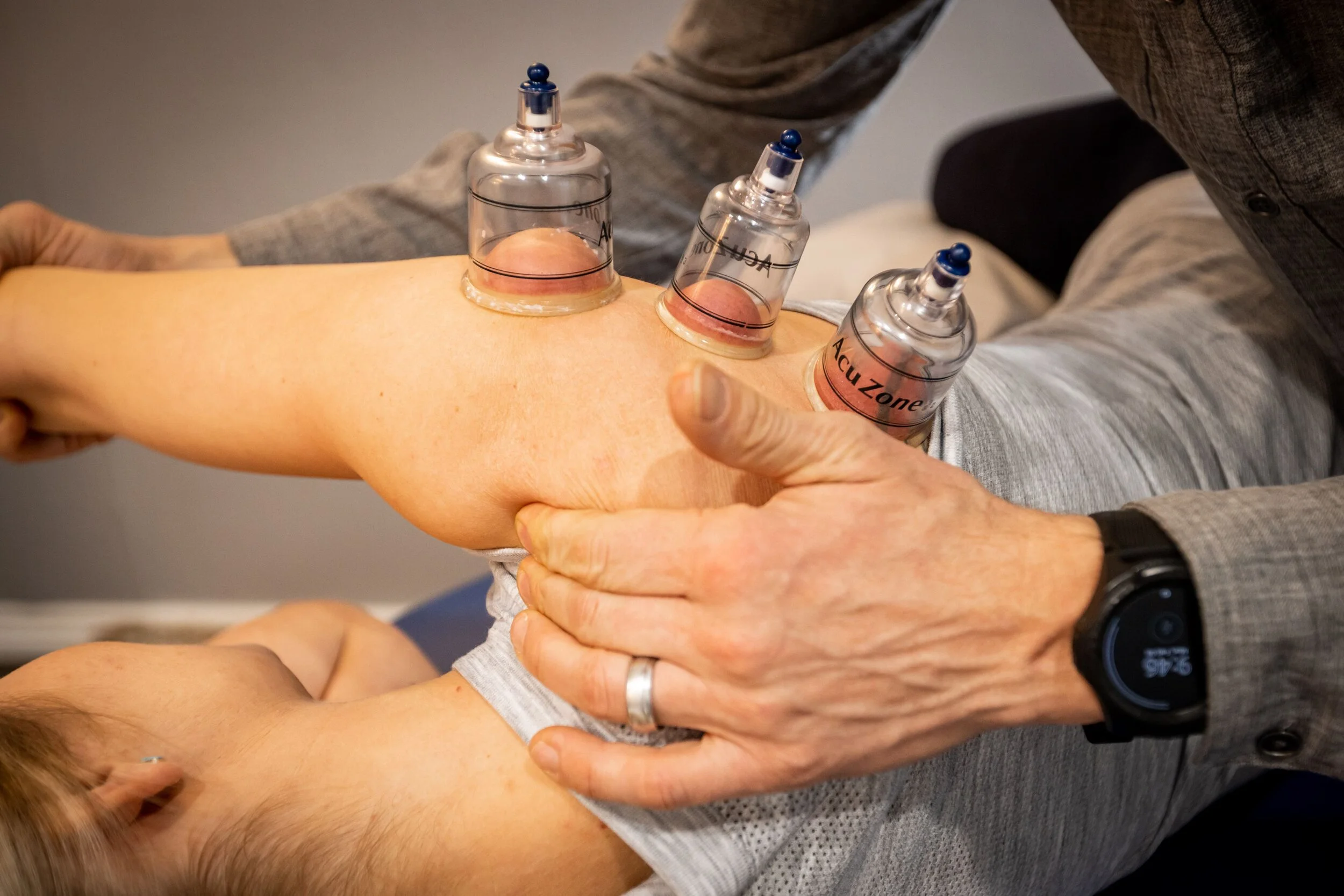 Cupping 2.jpeg