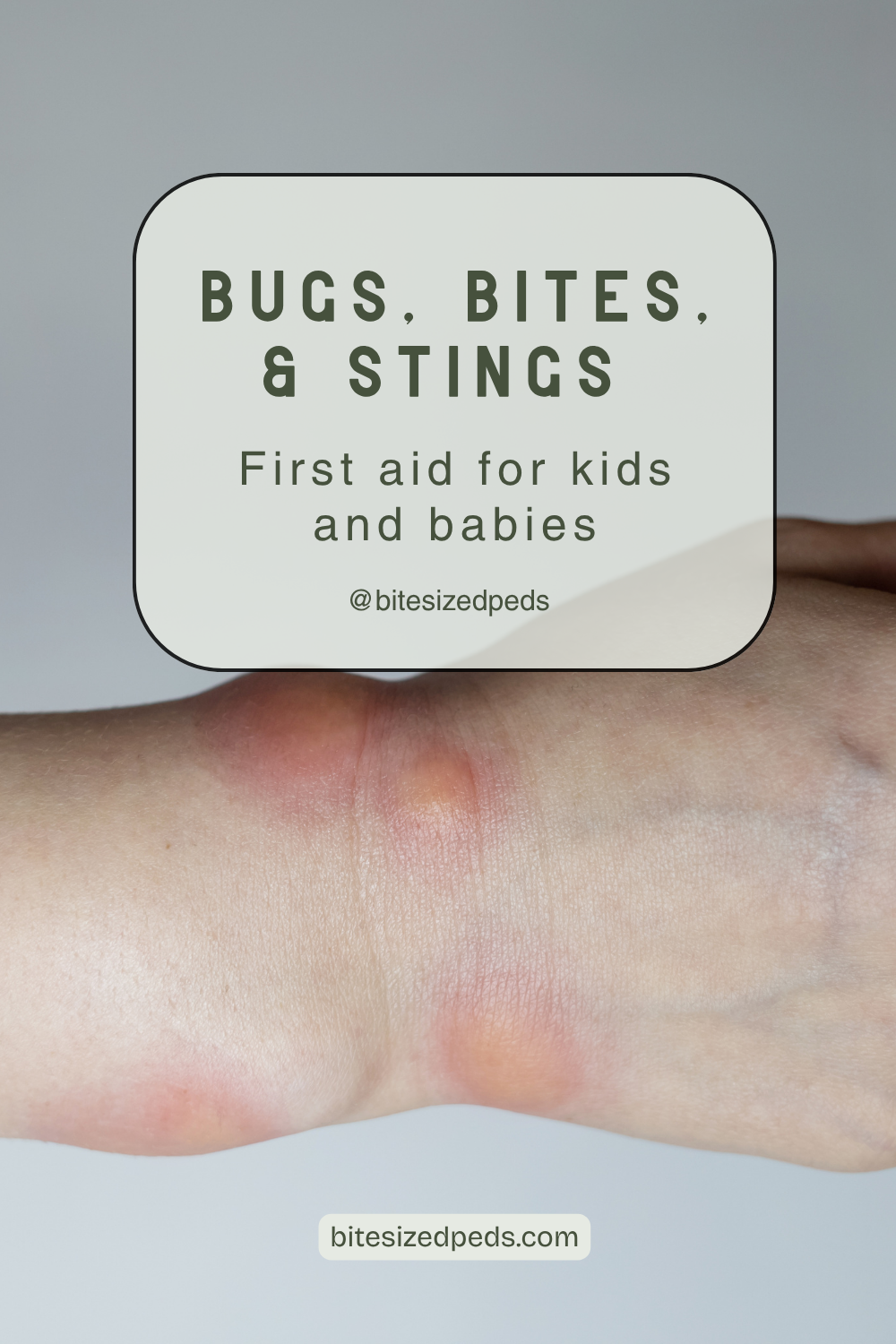 Bugs, Bites, &amp; Stings: A Parent’s Guide to First Aid for Kids