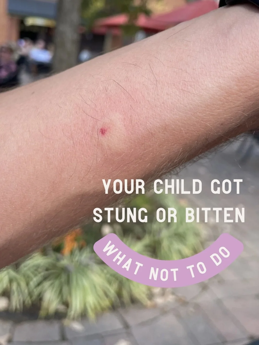 Most bites are totally normal reactions that just look scary and, honestly more annoying than anything. 

Knowing how to care for them at home vs scrambling in the moment can be all the boost of confidence you need! 

Comment BUGS for the full breakd