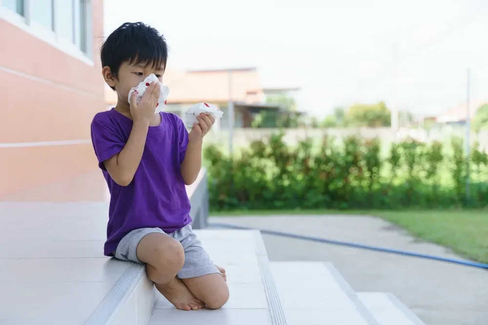 boy using tissue to cover a nosebleed