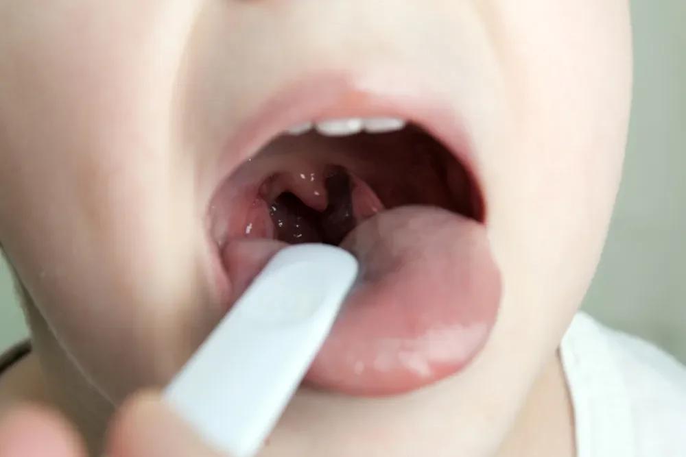 Doctor checking a patient’s throat