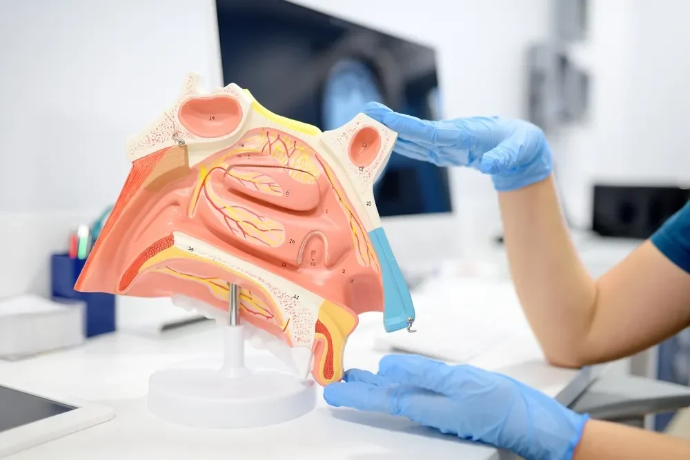ENT doctor using a nose model to explain chronic sinusitis.