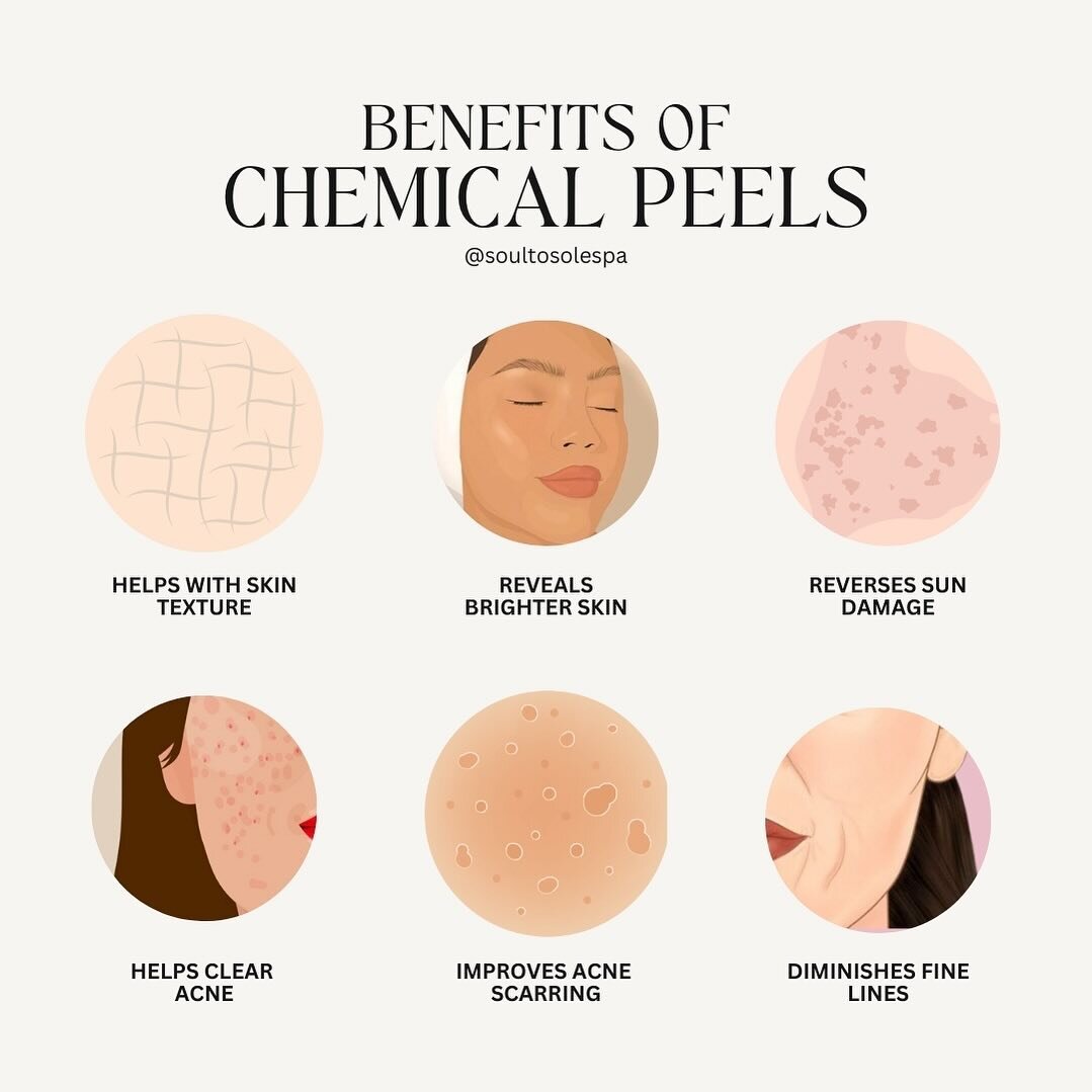 But like, who doesn&rsquo;t want smoother, brighter, more youthful skin? 💫

Chemical Peels are best done with multiple series for best results!
Send me a Message to book your Chemical Peel Today!

@soultosolespa

*
*
*

#perfectskin #skincareroutine