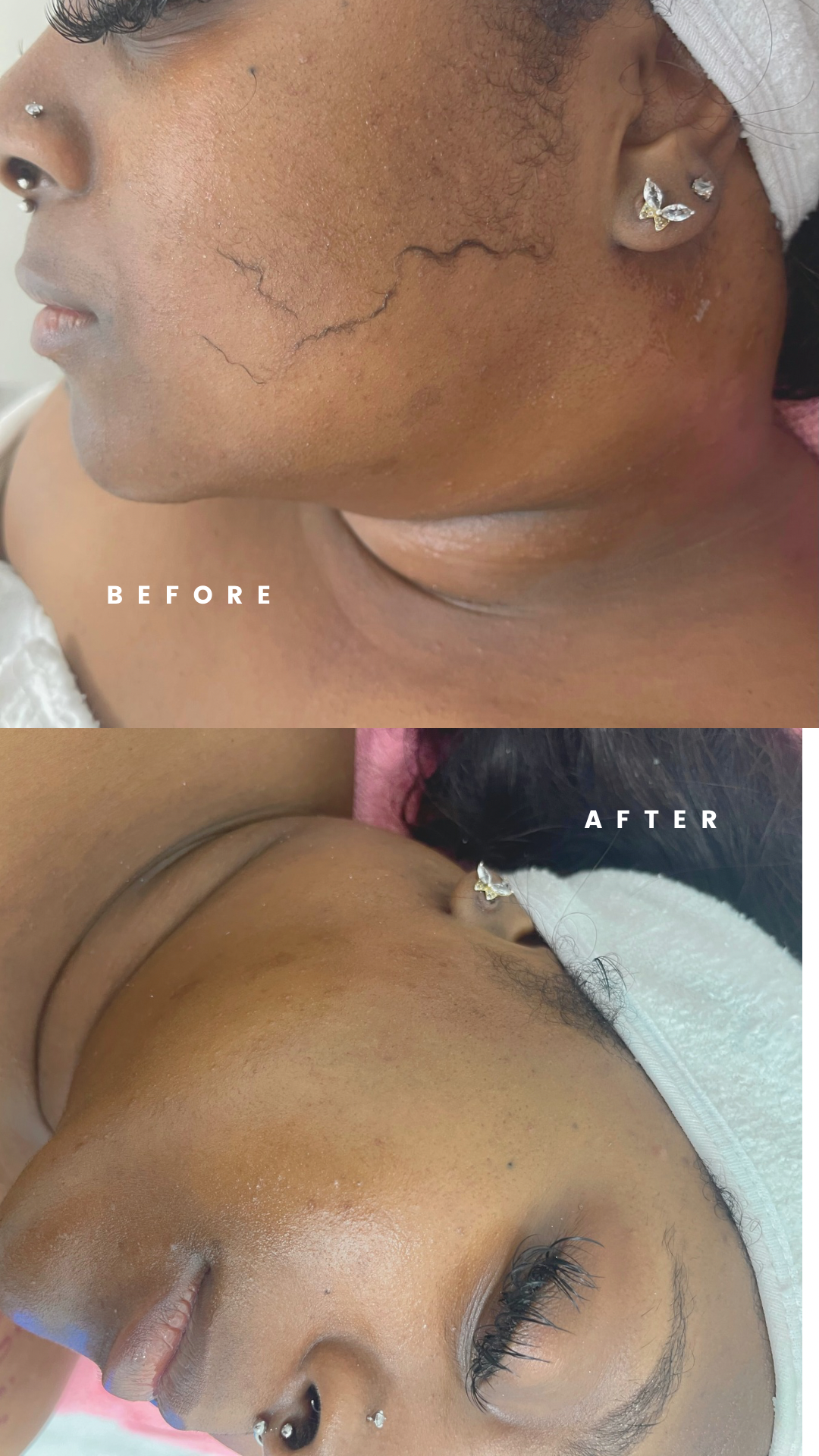 How Professional Skin Care Treatments Improve Texture and Tone